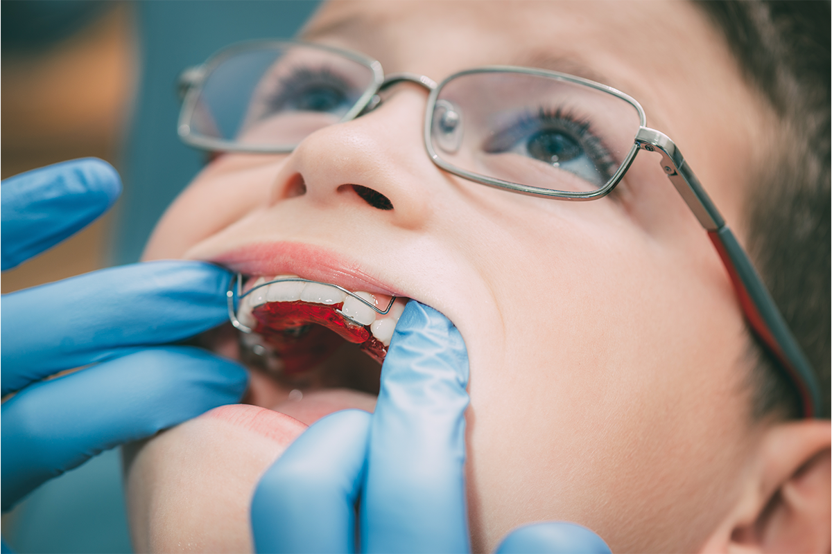 Aparato dental para niños en Castro&Umaña Ortodoncia